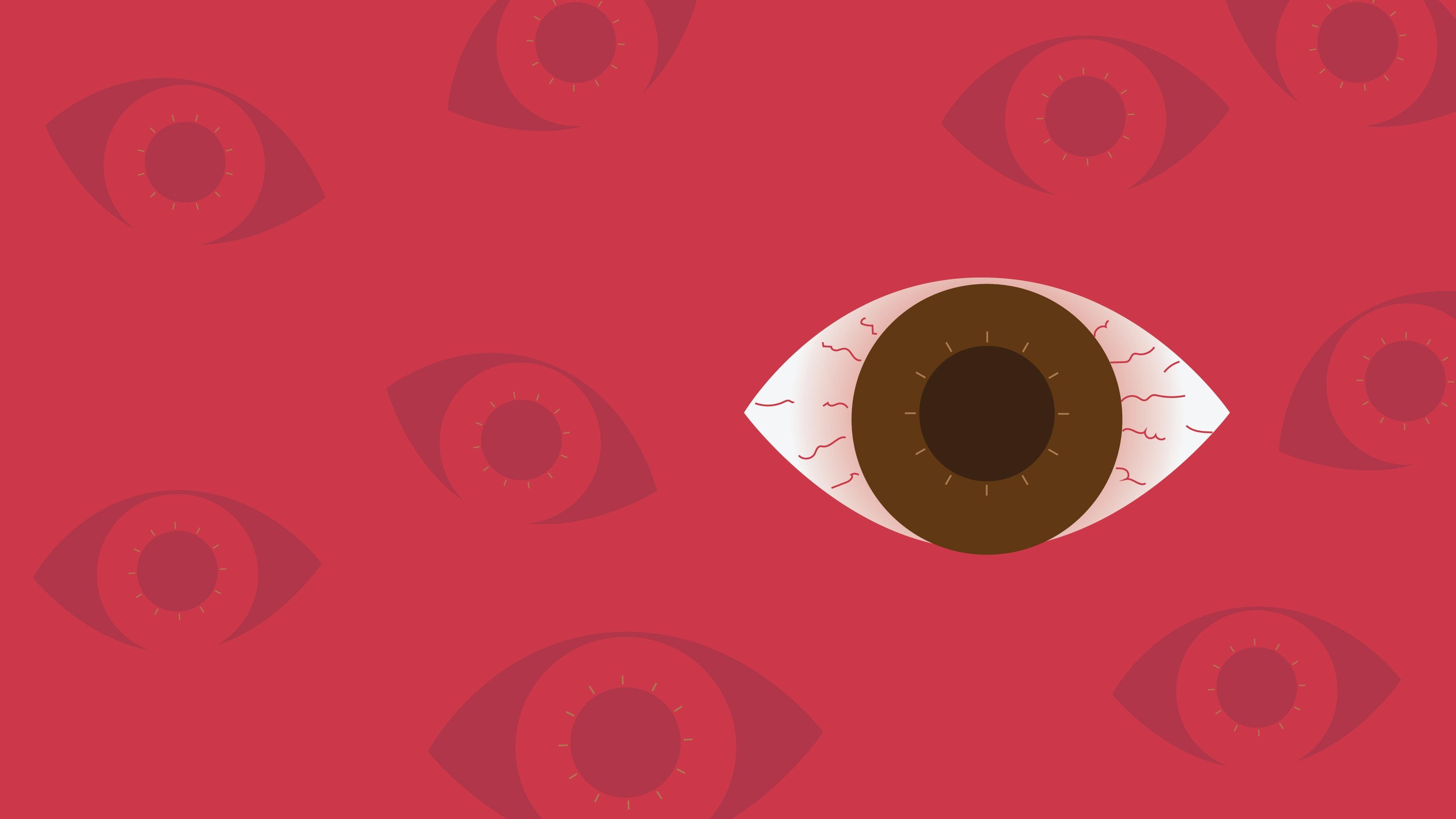 ER EYE